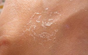 Isperutana koza izbliza